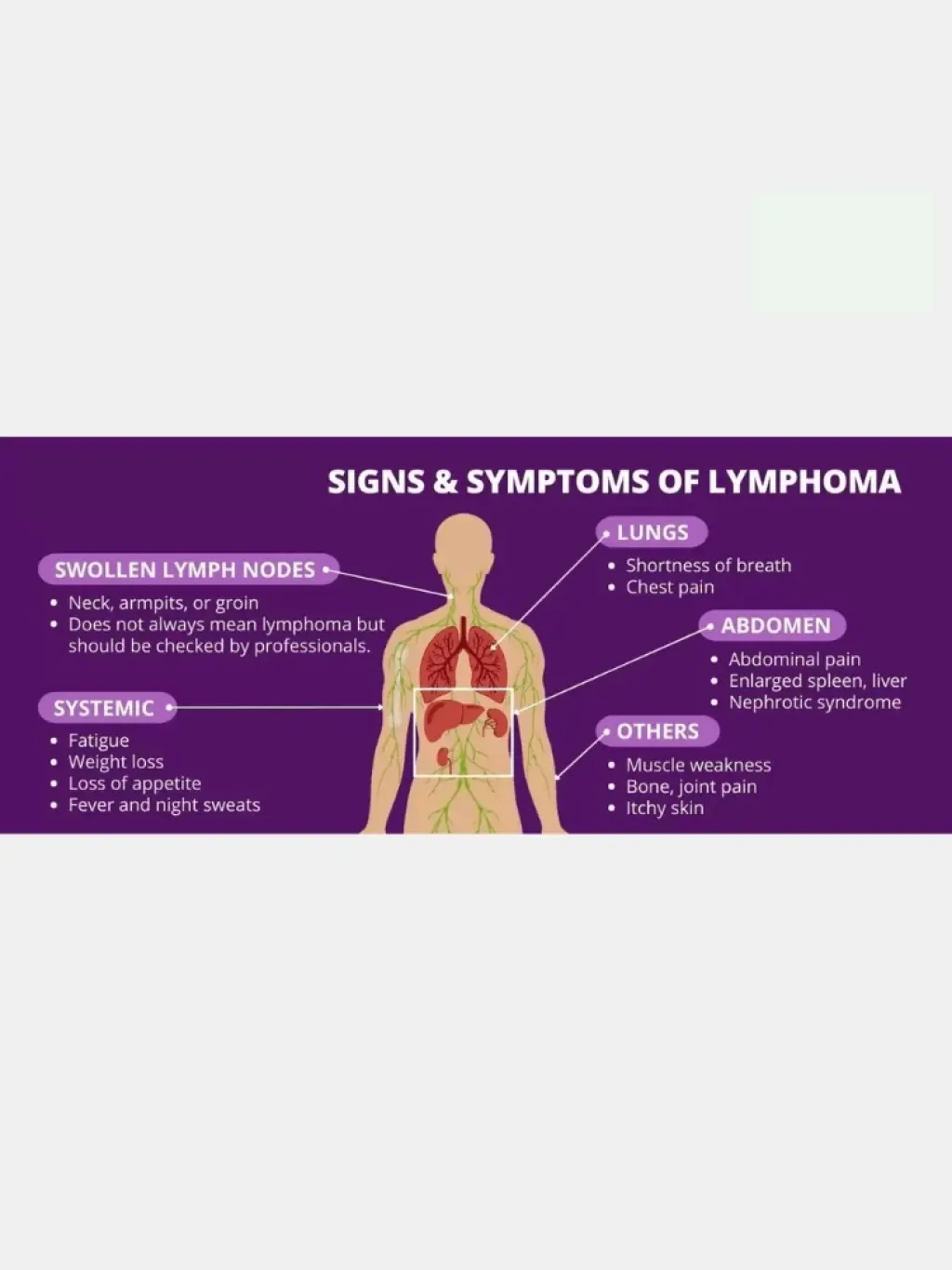SLL Cancer Explained: Symptoms, Causes, and Treatment Options (2026 Guide)