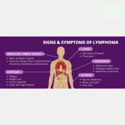 SLL Cancer Explained: Symptoms, Causes, and Treatment Options (2026 Guide)